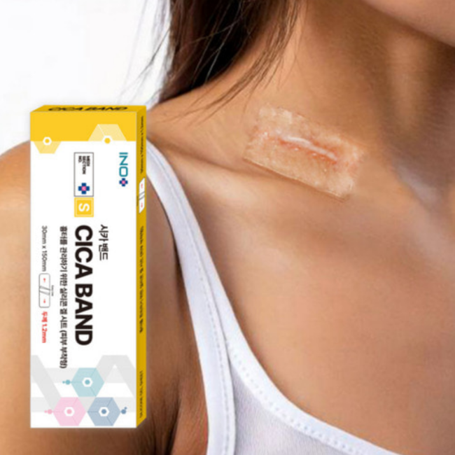 메디섹션 넘버S 시카 밴드 3 x 15cm 1.2mm 1개입