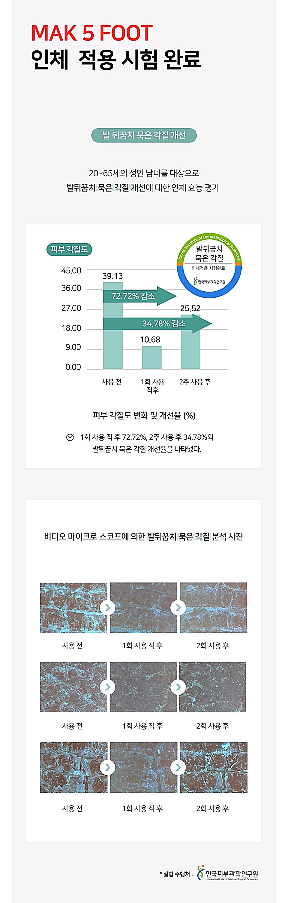 더막 발냄새 발각질케어 인공피부막 막5풋