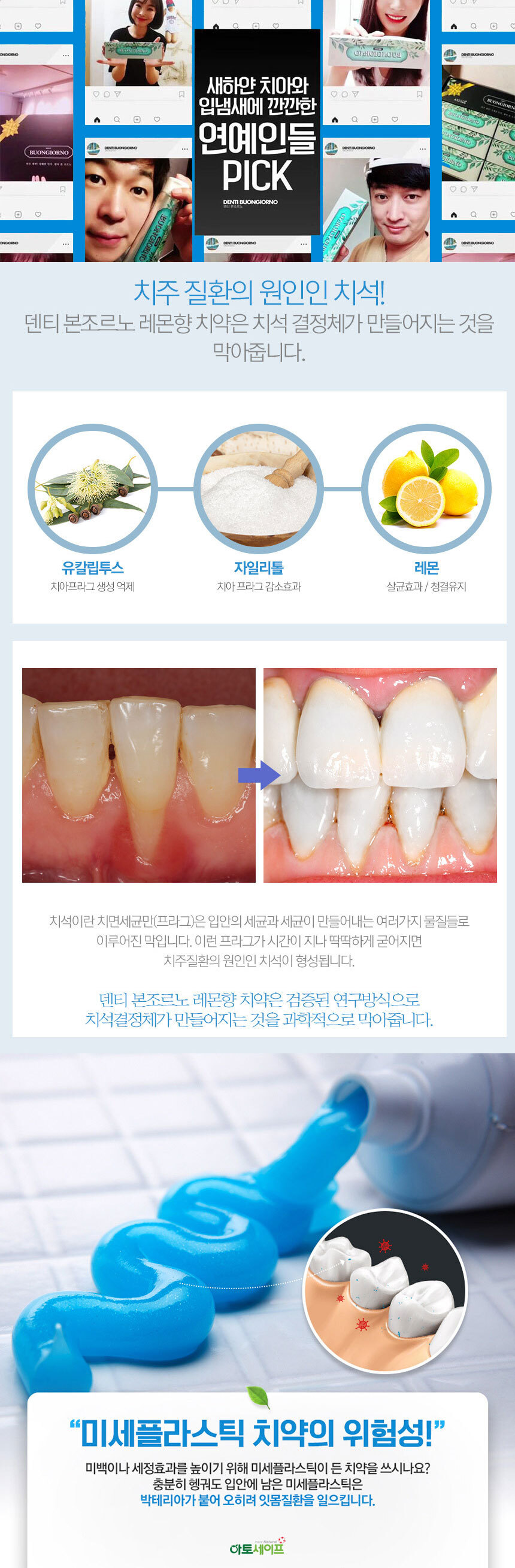 덴티본조르노 100g 4개 (치석치약)(리뉴얼전)  (115791)